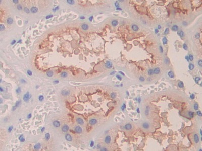 Polyclonal Antibody to Bruton'S Tyrosine Kinase (Btk)