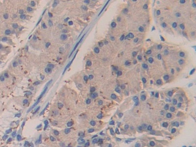 Polyclonal Antibody to Bruton'S Tyrosine Kinase (Btk)