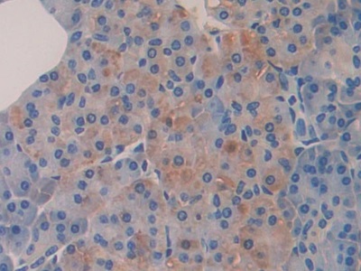 Polyclonal Antibody to Bruton'S Tyrosine Kinase (Btk)