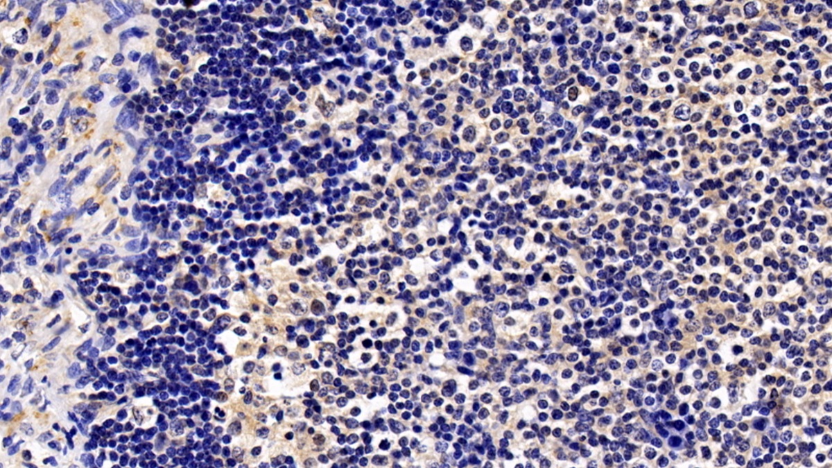 Polyclonal Antibody to Bruton'S Tyrosine Kinase (Btk)