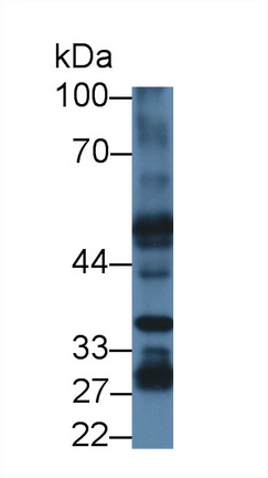 Polyclonal Antibody to Phosphatidylserine Receptor (PSR)