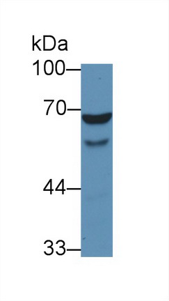 Polyclonal Antibody to Wiskott Aldrich Syndrome Protein (WASP)