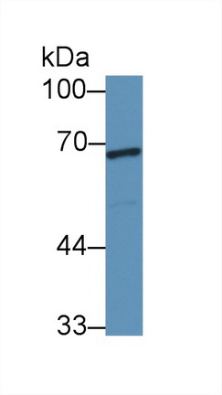 Polyclonal Antibody to Wiskott Aldrich Syndrome Protein (WASP)