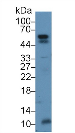 Polyclonal Antibody to Angiopoietin Like Protein 2 (ANGPTL2)