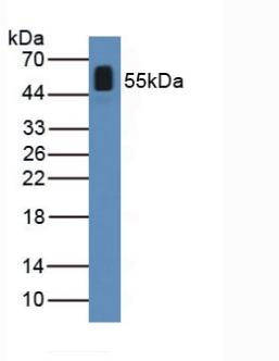 Polyclonal Antibody to Angiopoietin Like Protein 2 (ANGPTL2)