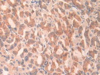 Polyclonal Antibody to Angiopoietin Like Protein 2 (ANGPTL2)