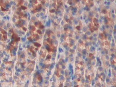 Polyclonal Antibody to Angiopoietin Like Protein 2 (ANGPTL2)