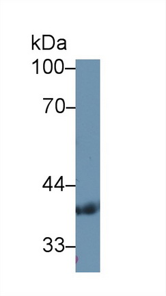 Polyclonal Antibody to Pyruvate Dehydrogenase Beta (PDHb)