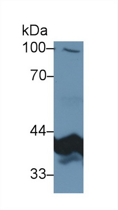 Polyclonal Antibody to Pyruvate Dehydrogenase Beta (PDHb)