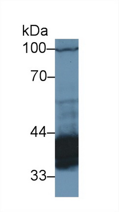 Polyclonal Antibody to Pyruvate Dehydrogenase Beta (PDHb)