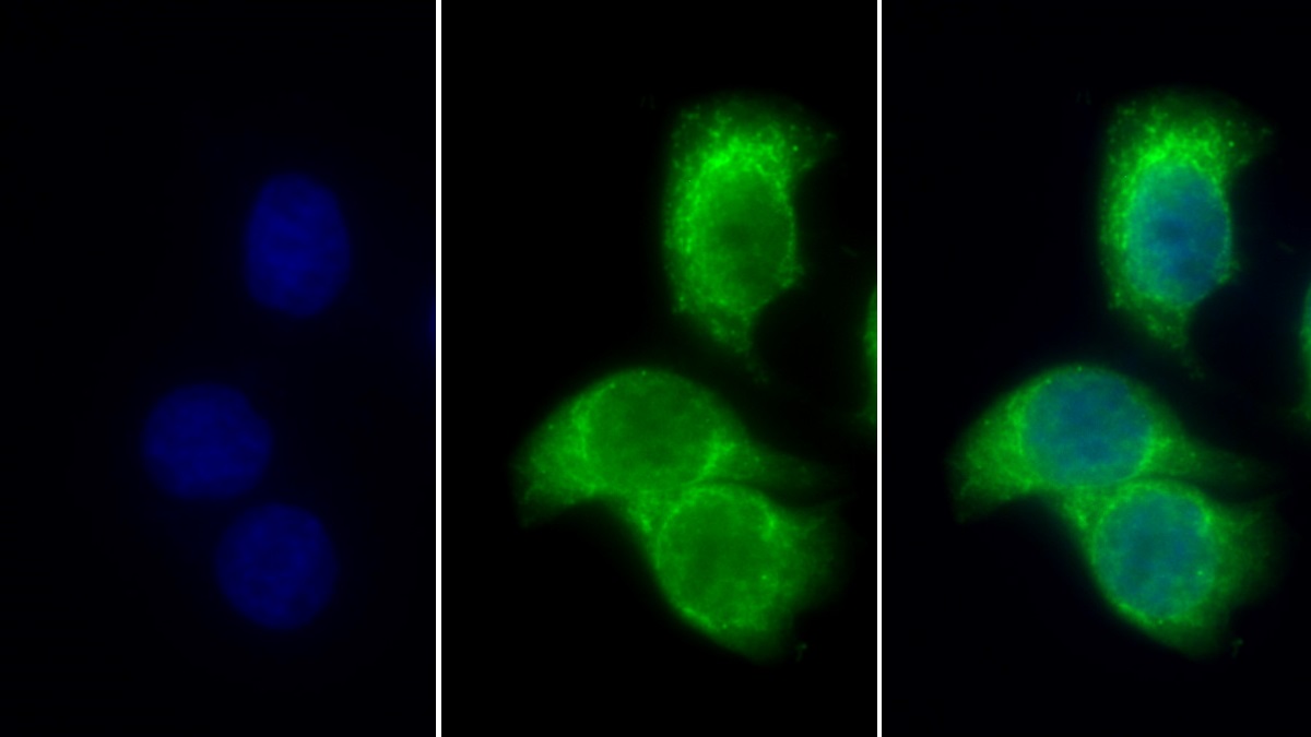 Polyclonal Antibody to Pyruvate Dehydrogenase Beta (PDHb)