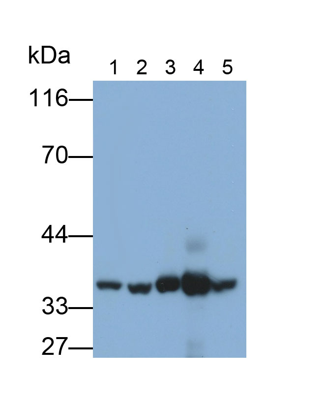 Polyclonal Antibody to Pyruvate Dehydrogenase Beta (PDHb)