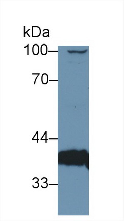 Polyclonal Antibody to Pyruvate Dehydrogenase Beta (PDHb)