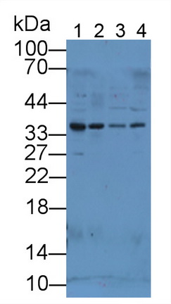 Polyclonal Antibody to Pyruvate Dehydrogenase Beta (PDHb)