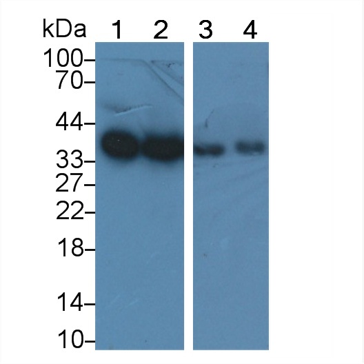 Polyclonal Antibody to Pyruvate Dehydrogenase Beta (PDHb)