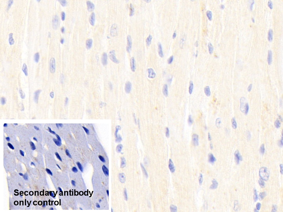 Polyclonal Antibody to Pyruvate Dehydrogenase Beta (PDHb)