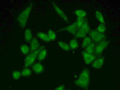 Polyclonal Antibody to Fumarase (FUM)