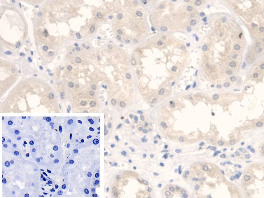 Polyclonal Antibody to Fumarase (FUM)