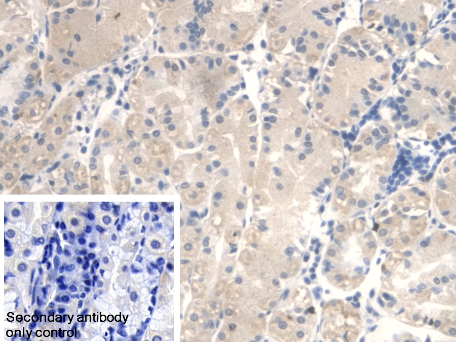 Polyclonal Antibody to Fumarase (FUM)