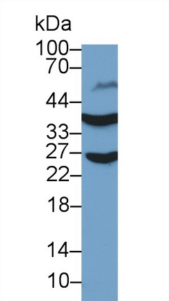 Polyclonal Antibody to Glyceraldehyde-3-Phosphate Dehydrogenase (GAPDH)