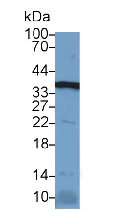 Polyclonal Antibody to Glyceraldehyde-3-Phosphate Dehydrogenase (GAPDH)