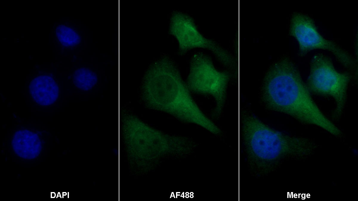 Polyclonal Antibody to Glyceraldehyde-3-Phosphate Dehydrogenase (GAPDH)