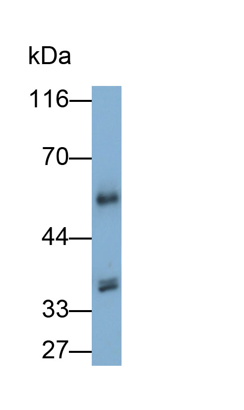 Polyclonal Antibody to Glyceraldehyde-3-Phosphate Dehydrogenase (GAPDH)