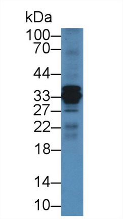 Polyclonal Antibody to Cathepsin S (CTSS)