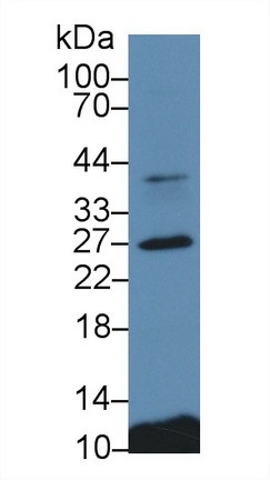 Polyclonal Antibody to Cathepsin S (CTSS)