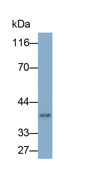 Polyclonal Antibody to Cathepsin S (CTSS)