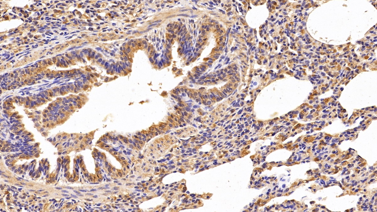 Polyclonal Antibody to Cathepsin S (CTSS)