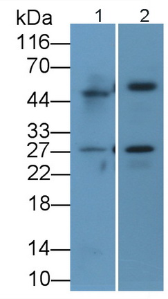 Polyclonal Antibody to Cathepsin S (CTSS)