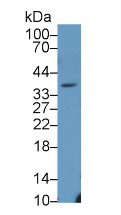 Polyclonal Antibody to Cathepsin S (CTSS)