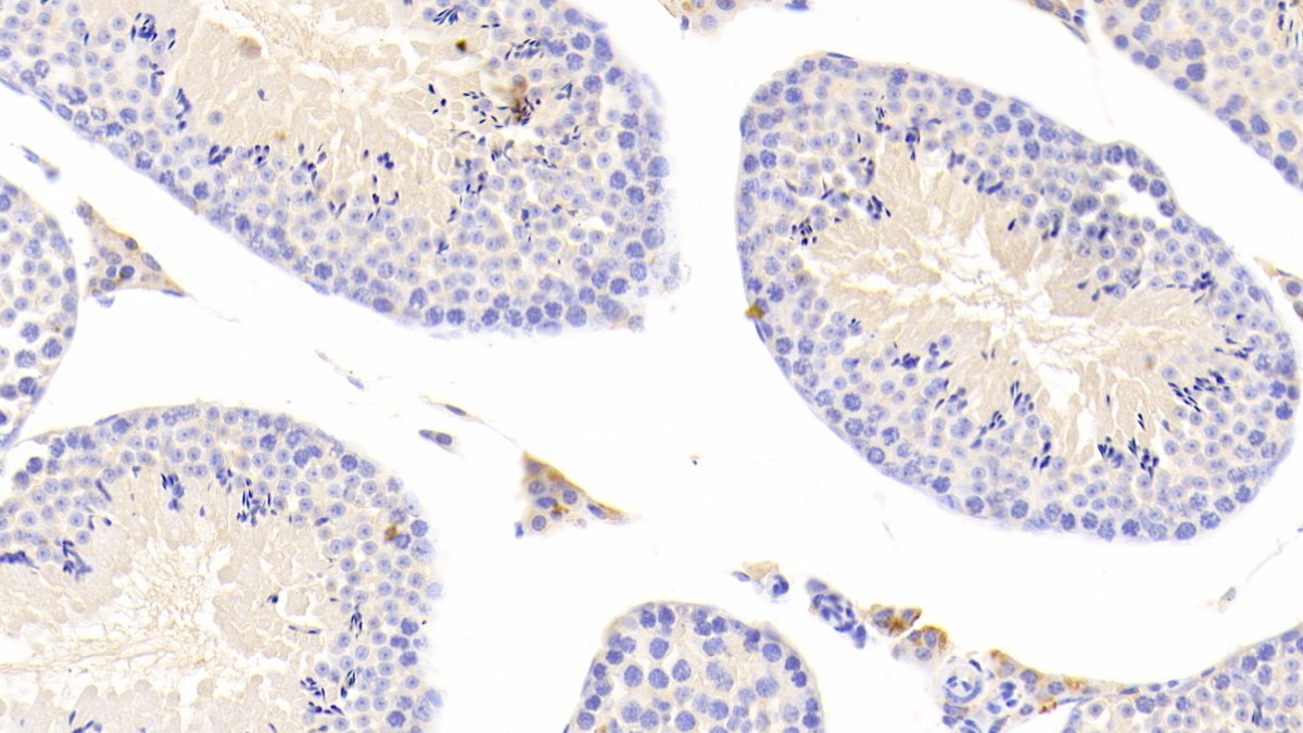 Polyclonal Antibody to Cathepsin S (CTSS)