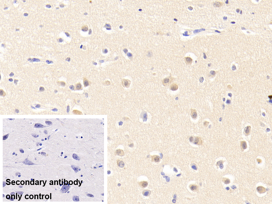 Polyclonal Antibody to Tenascin X (TNX)