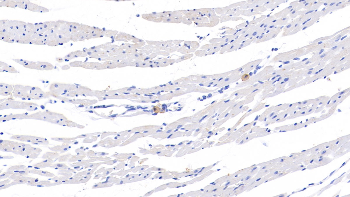 Polyclonal Antibody to Immunoglobulin D (IgD)