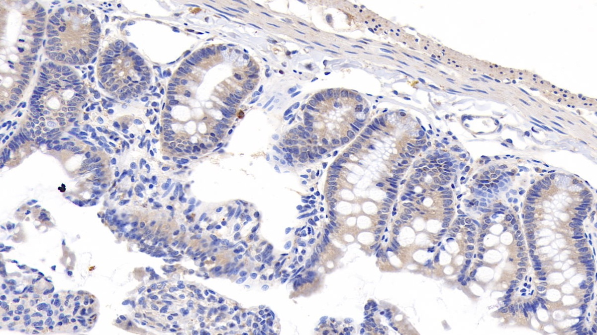 Polyclonal Antibody to Immunoglobulin D (IgD)