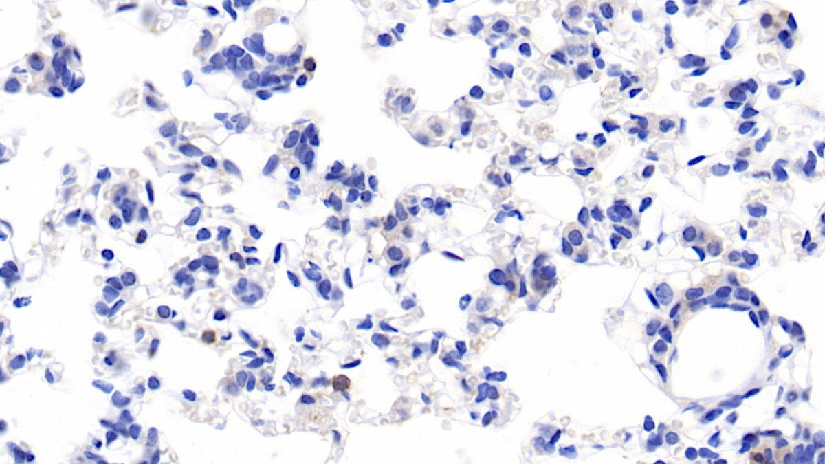 Polyclonal Antibody to Immunoglobulin D (IgD)