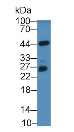 Polyclonal Antibody to Neurofibromin 2 (NF2)