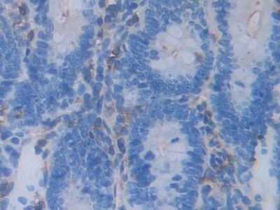 Polyclonal Antibody to Acrosin (ACR)