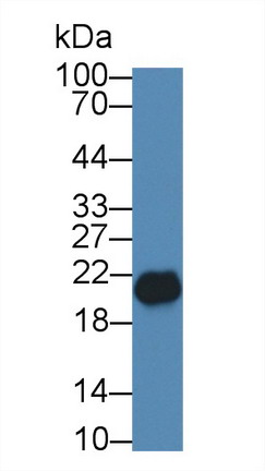 Polyclonal Antibody to Sperm Protein 17 (Sp17)