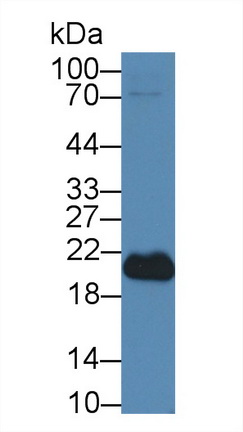 Polyclonal Antibody to Sperm Protein 17 (Sp17)