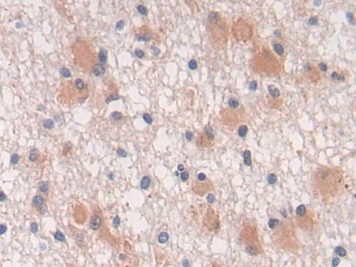 Polyclonal Antibody to Transforming Growth Factor Beta 3 (TGFb3)