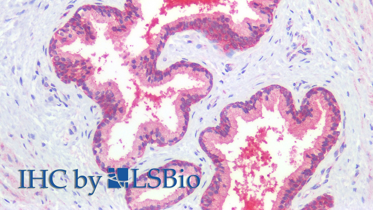 Polyclonal Antibody to Transforming Growth Factor Beta 3 (TGFb3)