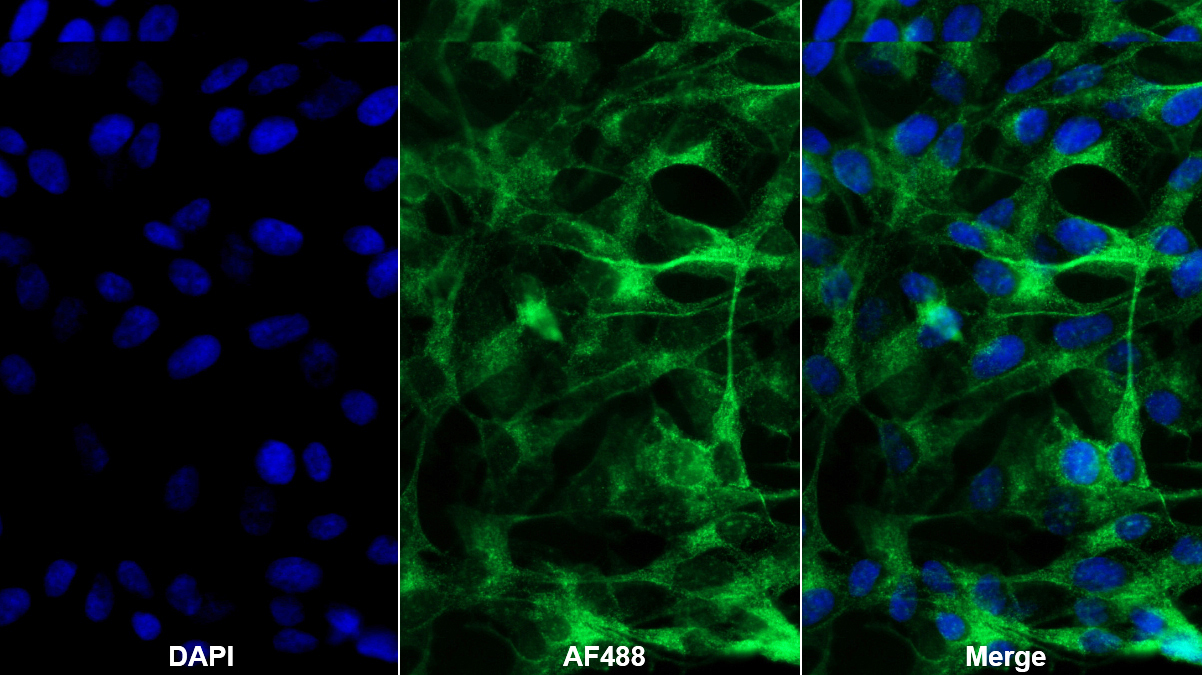 Polyclonal Antibody to Transforming Growth Factor Beta 3 (TGFb3)