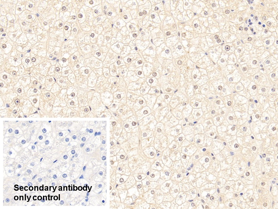 Polyclonal Antibody to Tar DNA Binding Protein 43kDa (TDP43)