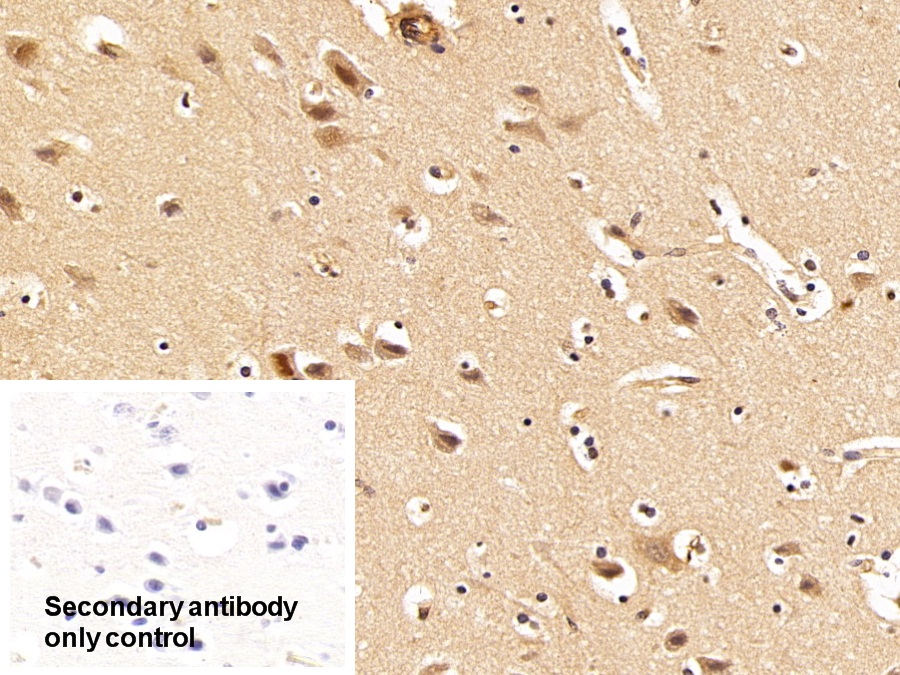 Polyclonal Antibody to Tar DNA Binding Protein 43kDa (TDP43)