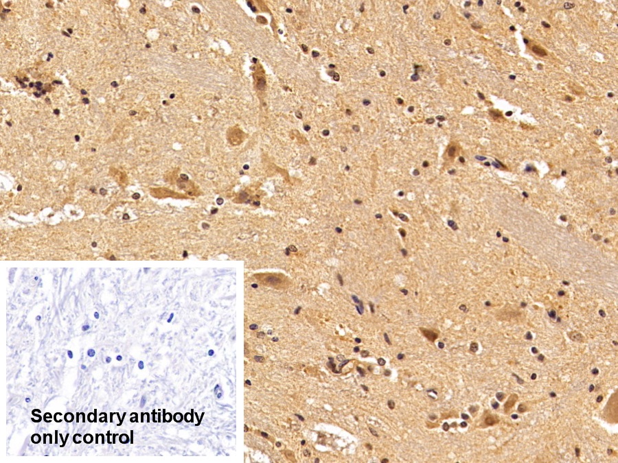 Polyclonal Antibody to Tar DNA Binding Protein 43kDa (TDP43)