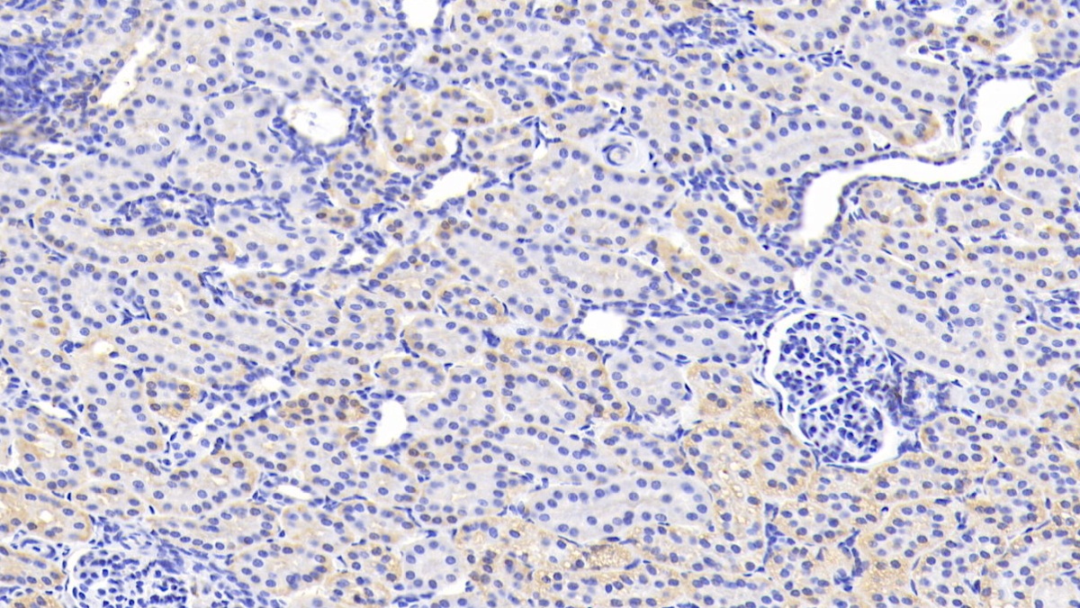 Polyclonal Antibody to Inhibitor Of Nuclear Factor Kappa B Kinase Interacting Protein (IKBIP)