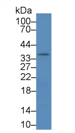 Polyclonal Antibody to Inhibitor Of Nuclear Factor Kappa B Kinase Interacting Protein (IKBIP)